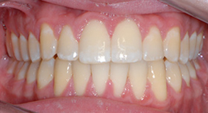 Before & Afters Before & Afters