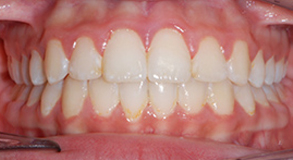 Before & Afters Before & Afters