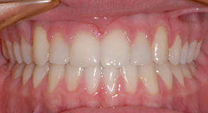 Before & Afters Before & Afters