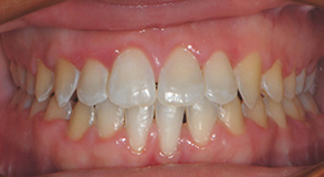 Before & Afters Before & Afters