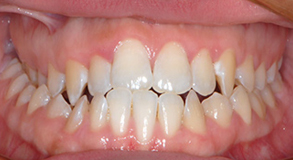 Before & Afters Before & Afters